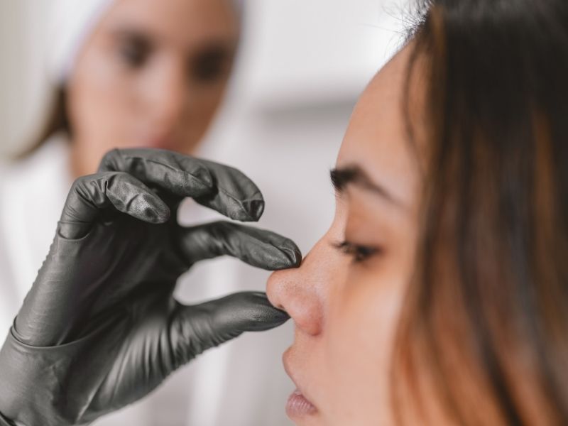 Antalya Burun Estetiği (1)